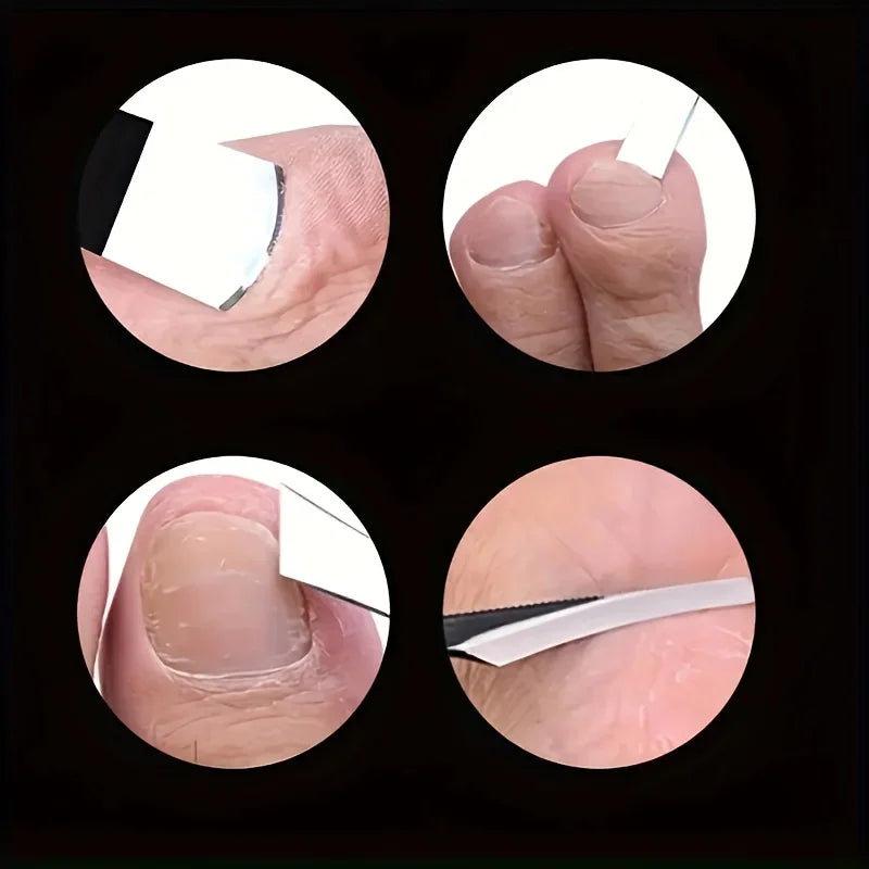 Stainless Steel Foot Care Sharp Exfoliating Knife Smooth Scraper Qme
