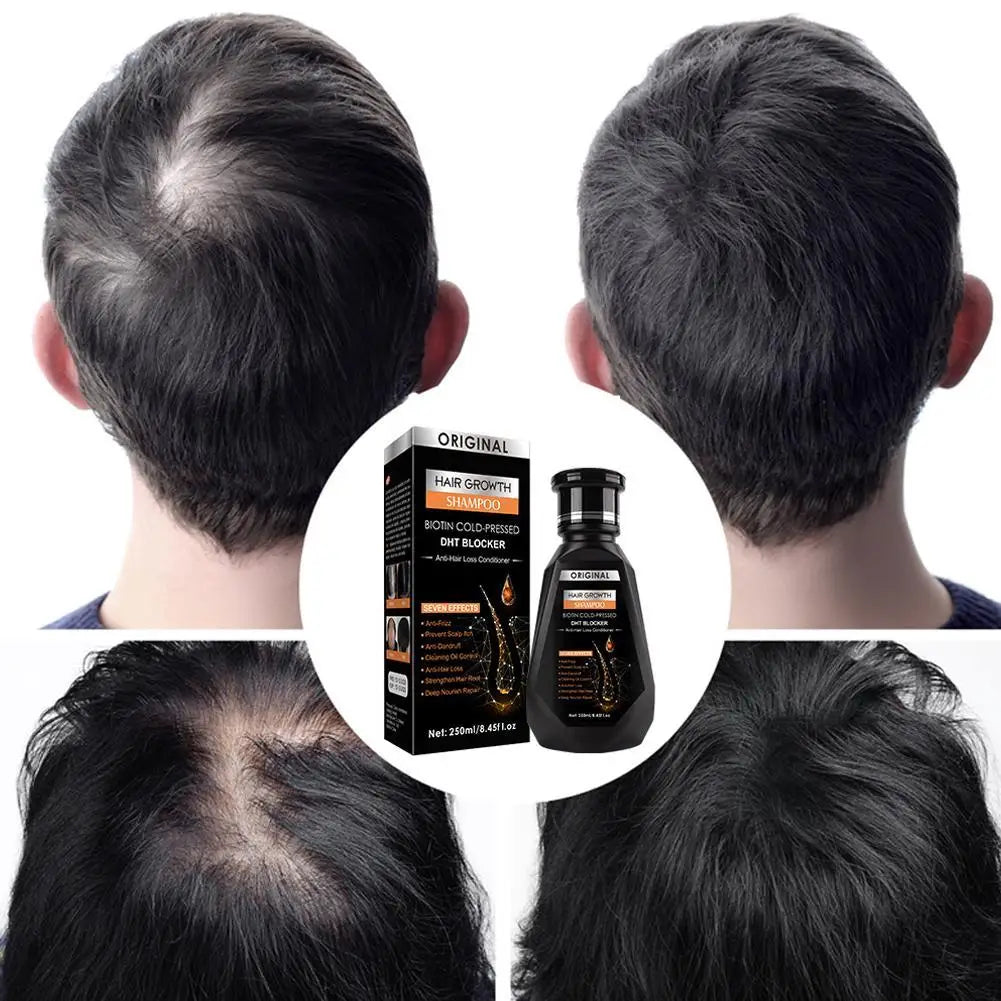Biotin Shampoo Hair Growth Thinning Ginger Thickening Formula Loss Qme