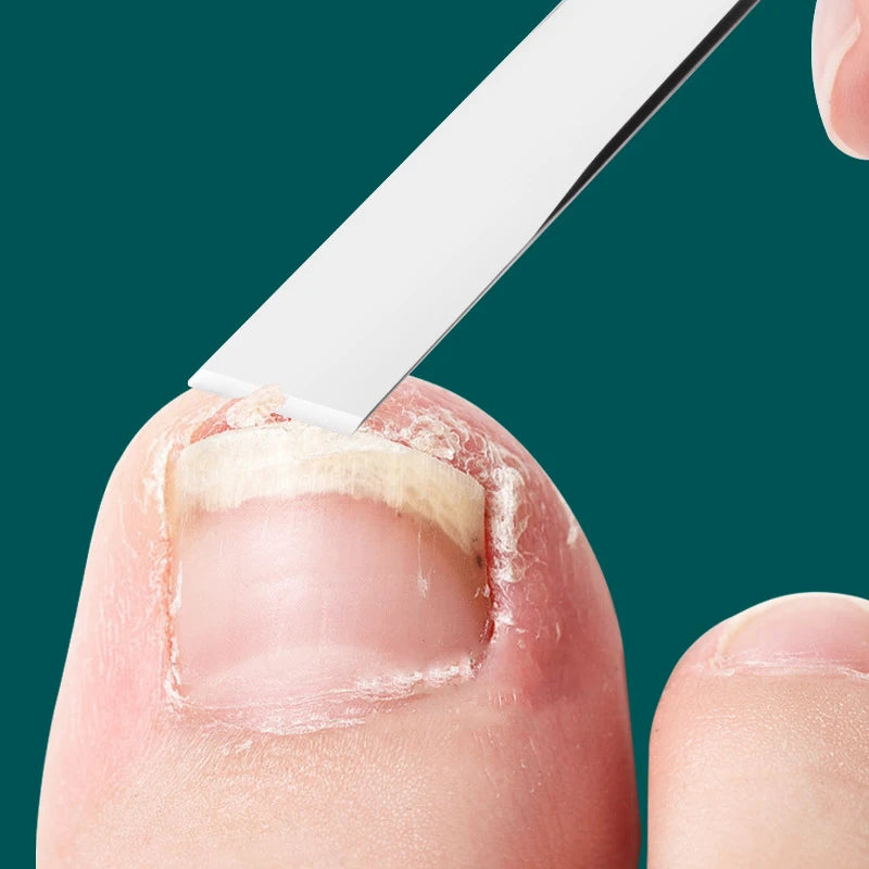 Heel Scraper Professional Foot Care Tool Callus Removal Dead Skin Qme