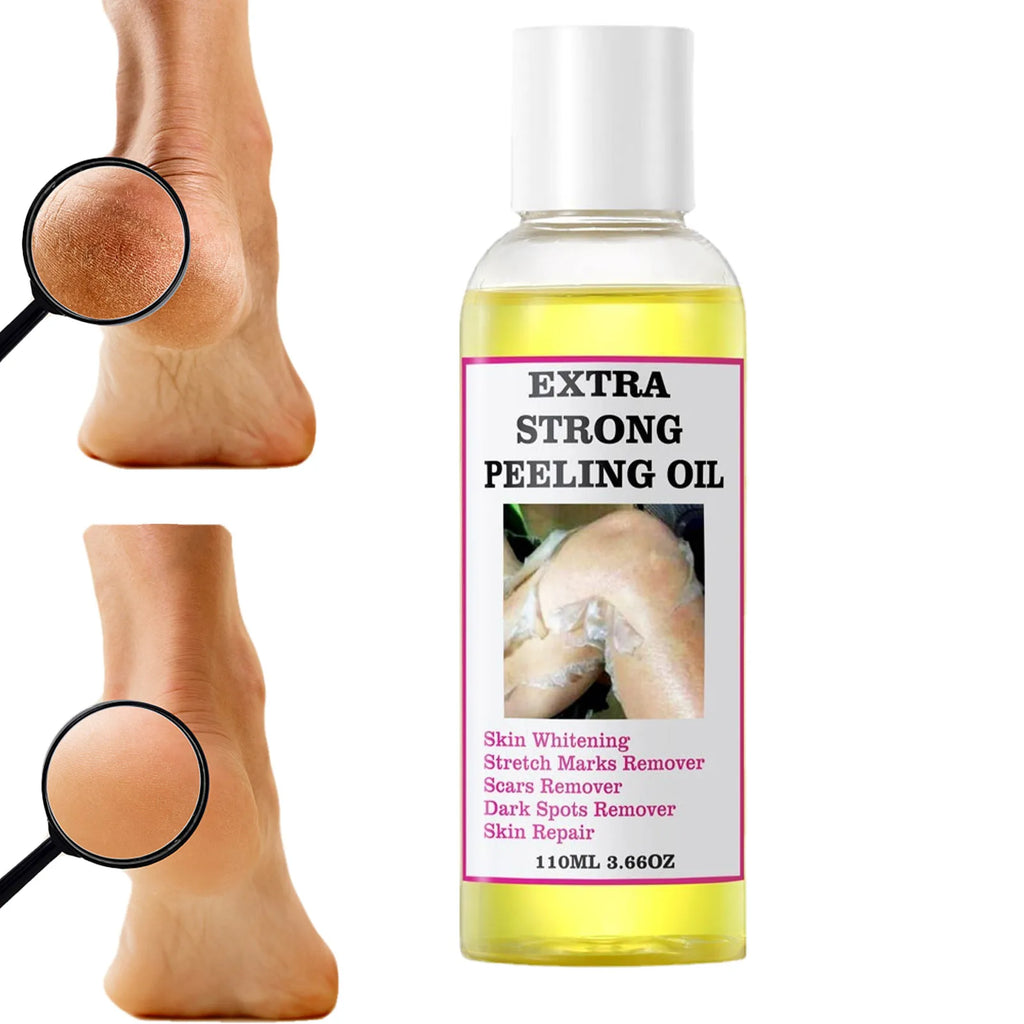 Peeling Oil Yellow Dark Spots Body Thai Hyaluronic Acid Strong Extra Qme