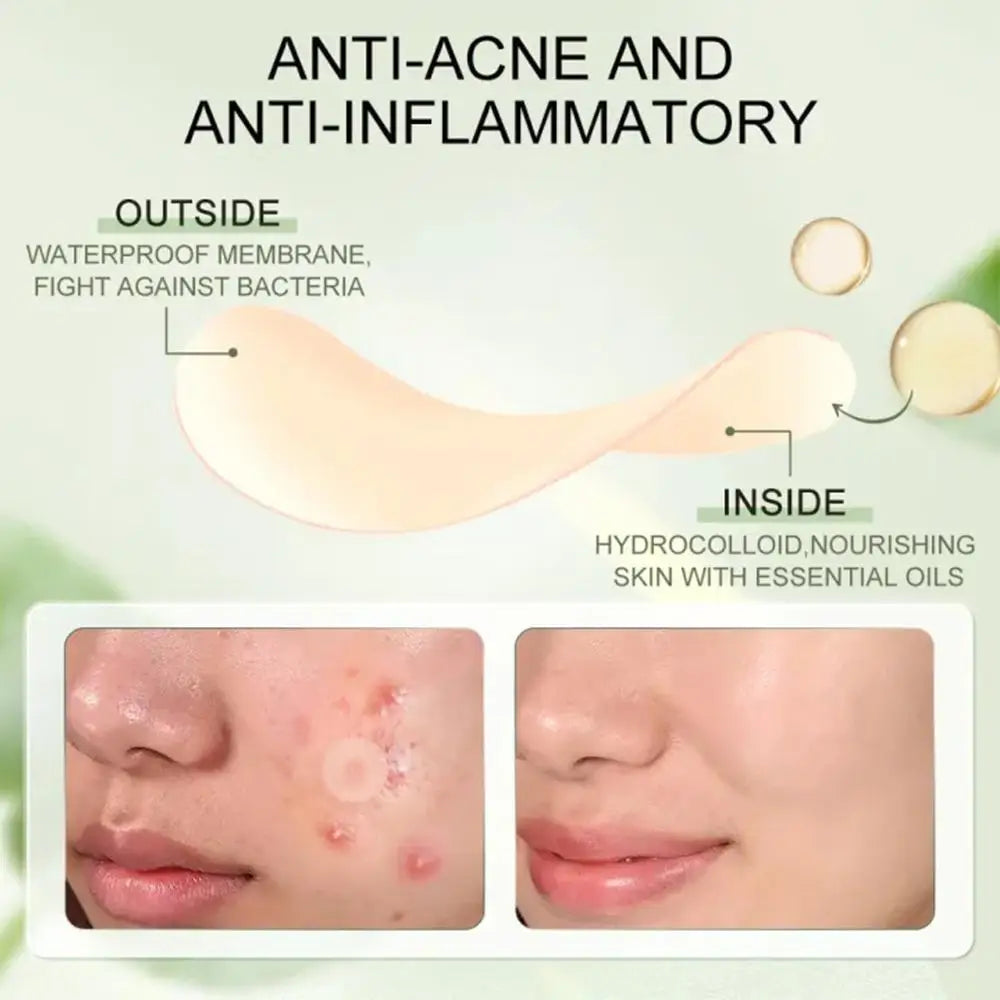 30pcs/BOX Hydrocolloid Salicylic Acne Pimple Patch Fade Repair Acne Invisible Removal Pimple Anti Spots Marks Conceale Qme