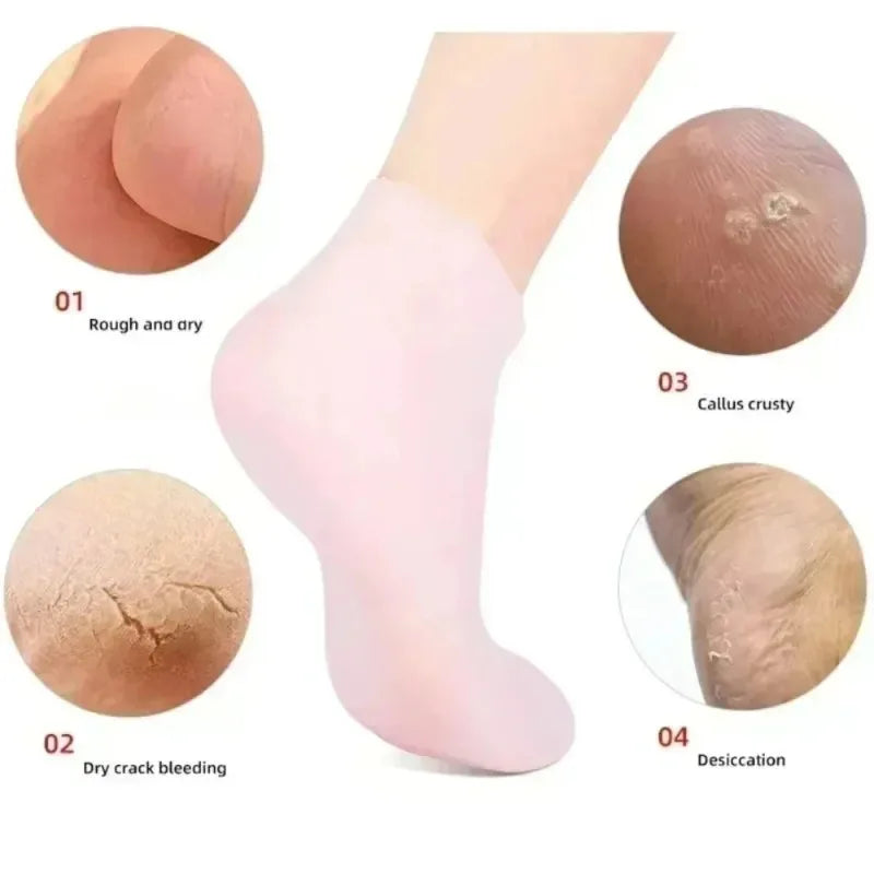 Spa Silicone Moisturizing Gloves Socks Hands Feet Care Prevents Dry Qme