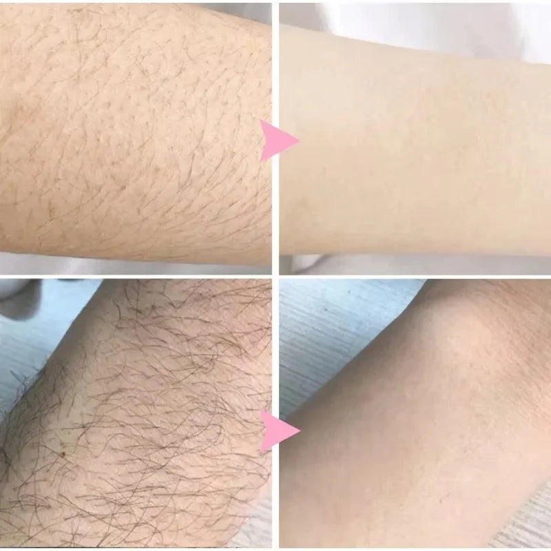 2 Minutes Painless Fast Hair Removal Spray Hair Growth Inhibitor Arm Armpit Leg Permanent Depilatory for Men Women Repair Care Qme