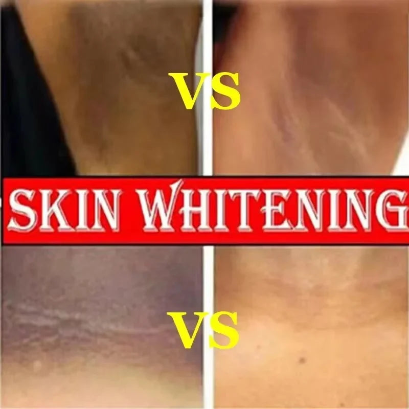 Retinol Whitening Cream Private Parts Underarm Bleaching Neck Lift Firm Butt Knee Brighten Inner Thigh Dark Remove Melanin 60g Qme