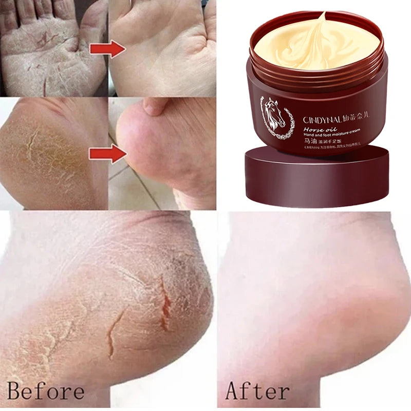 Horse Oil Skin Restoration Cream Repair Hand Moisturizing Foot Anti Qme