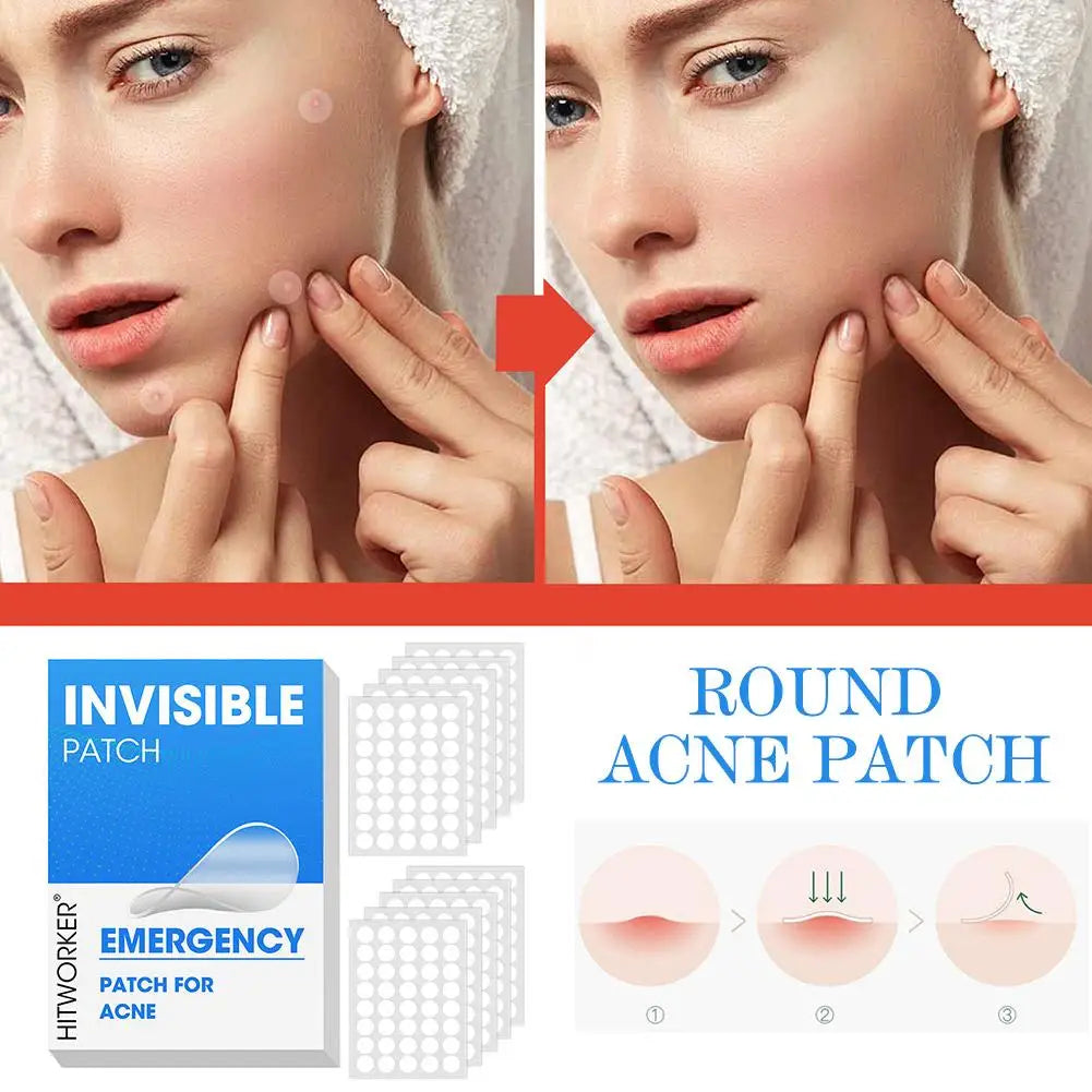 400-1200PCS Invisible Hydrocolloid Acne Patches Zit Spot Stickers For Covering Zits Blemishes With Salicylic Acid & Tea Tree Oil Qme