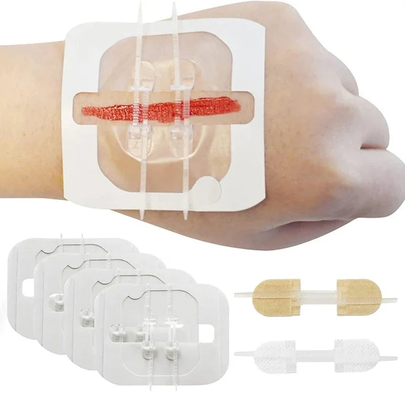 1 3 10 50 Patches Butterfly Closure Bandage Strips Adhesive Strip Qme
