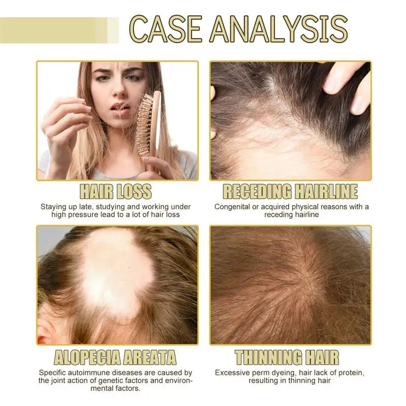 Natural Hair Growth Oil Rosemary Anti Hair Loss Regrowth Moisturizing Repair Anti Baldness Fast Hair Growth Serum Oil Qme