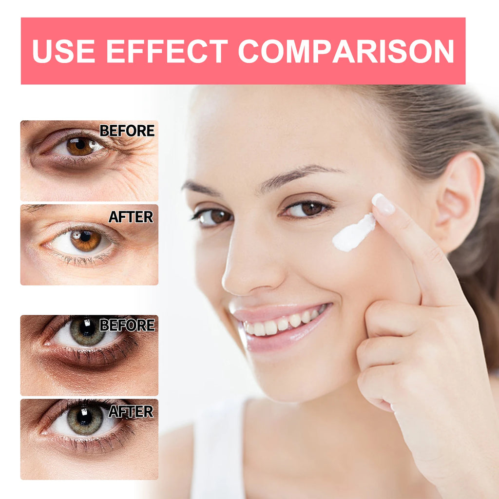 Retinol Eye Cream Stick Lightening Dark Circles Anti-Puffiness Smooth Brightening Moisturizing Firming Under Eye Treatment Care Qme