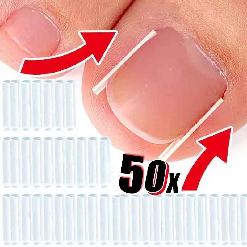 Inward Toe Nail Shaping Tool Invisible Care Pad Groove Adjust Clip Qme