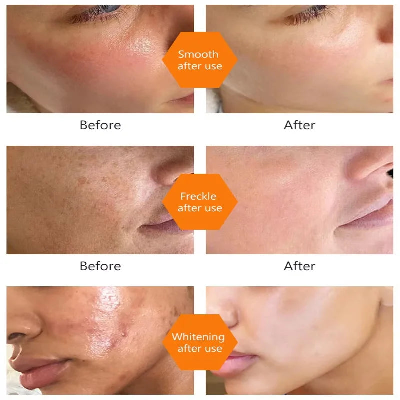 Dark Spot Remover Serum Turmeric Oil Whitening Freckle Facial Serum Anti-aging Reduce Fine Lines Lighten Spots Melanin Skin Care Qme