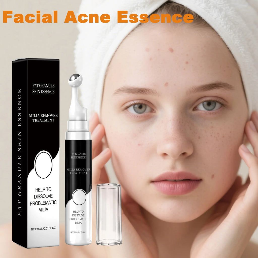 Salicylic Acid Facial Acne Treatment Serum Gentle Blemish Pimple Remover Oil Control Brighten Face Skin Moisturizing Skin Care Qme