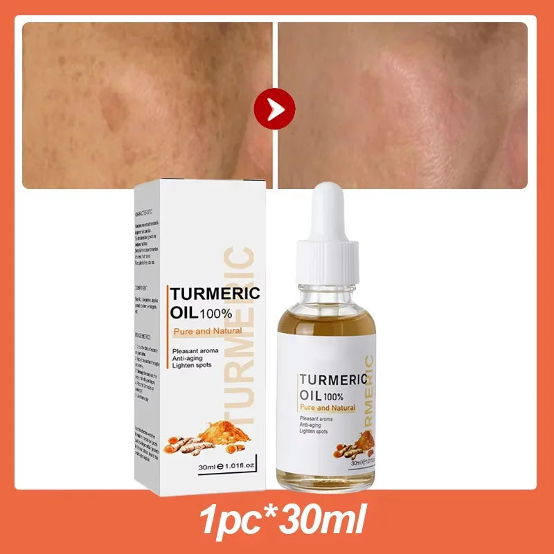 Turmeric Repair Essence For Reduces Dark Spots & Freckles Moisturizes Face Brightens And Evens Skin Tone Improves Damaged Skin Qme 1pc