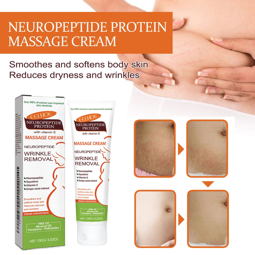 100g Stretch Marks Permanent Removal Cream Maternity Pregnant Women Pregnancy Anti-Winkle Smooth Repair Firming Skin Body Care Qme