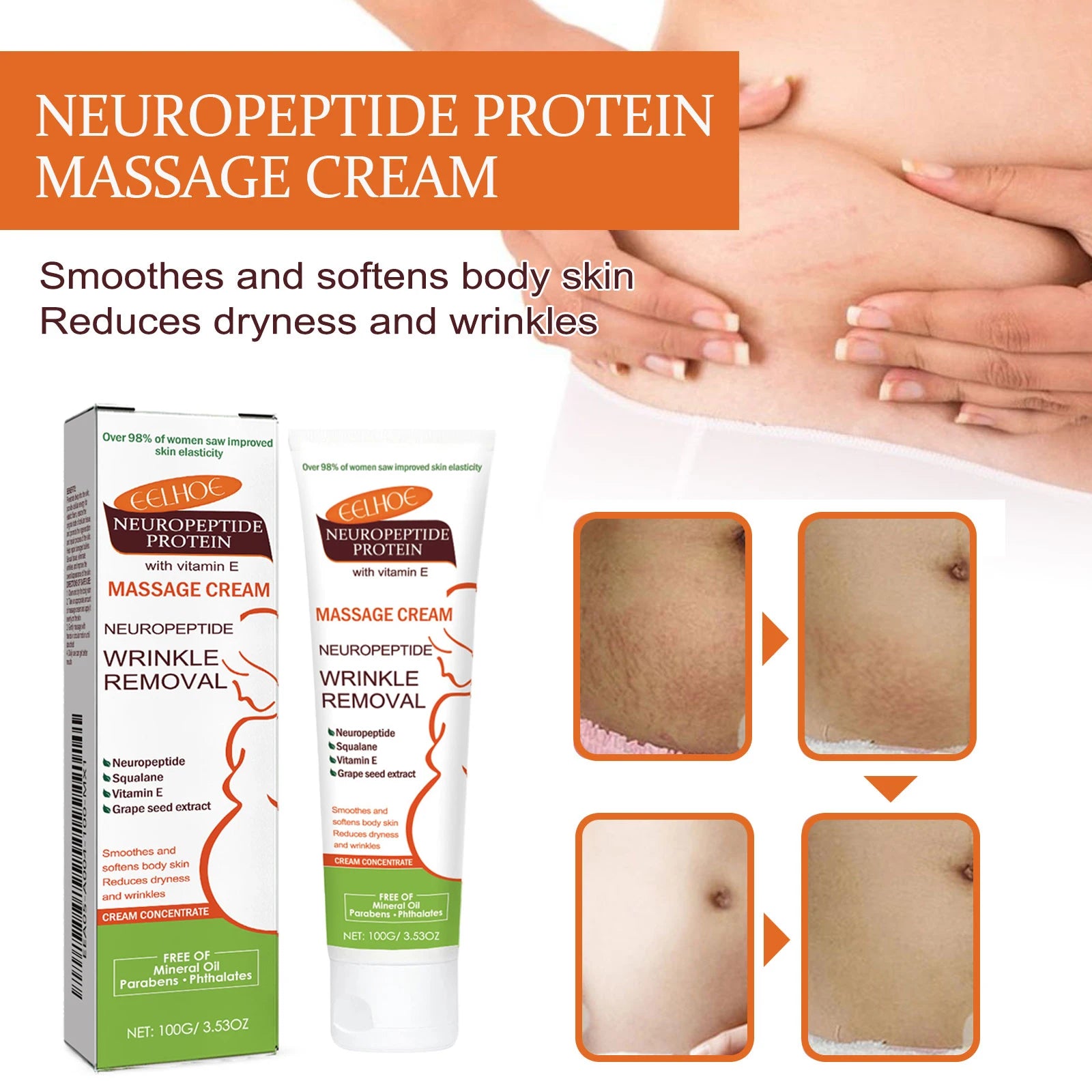 100g Stretch Marks Permanent Removal Cream Maternity Pregnant Women Pregnancy Anti-Winkle Smooth Repair Firming Skin Body Care Qme