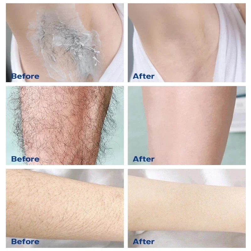 3 Minutes Fast Hair Removal Cream Painless Hair Growth Inhibitor Lip Face Arm Armpit Leg Permanent Depilatory for Men Women Care Qme