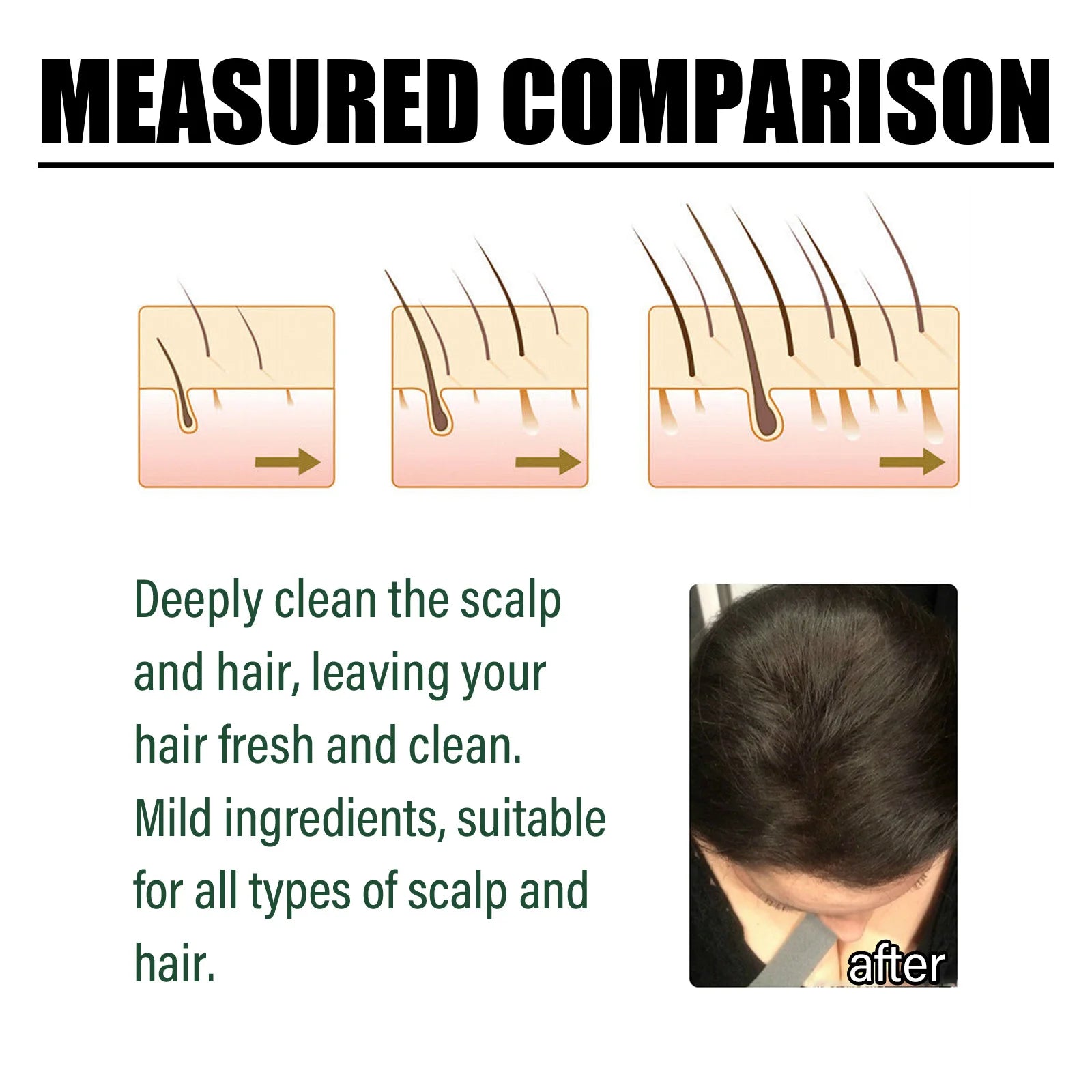 Hair Shampoo Anti-dandruff Oil Control Fluffy Refreshing Deep Qme