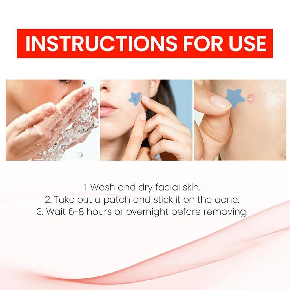 216PCS Pimple Patch Acne Colorful Invisible Acne Removal Skin Care Stickers Concealer Face Spot Beauty Makeup Tools Qme