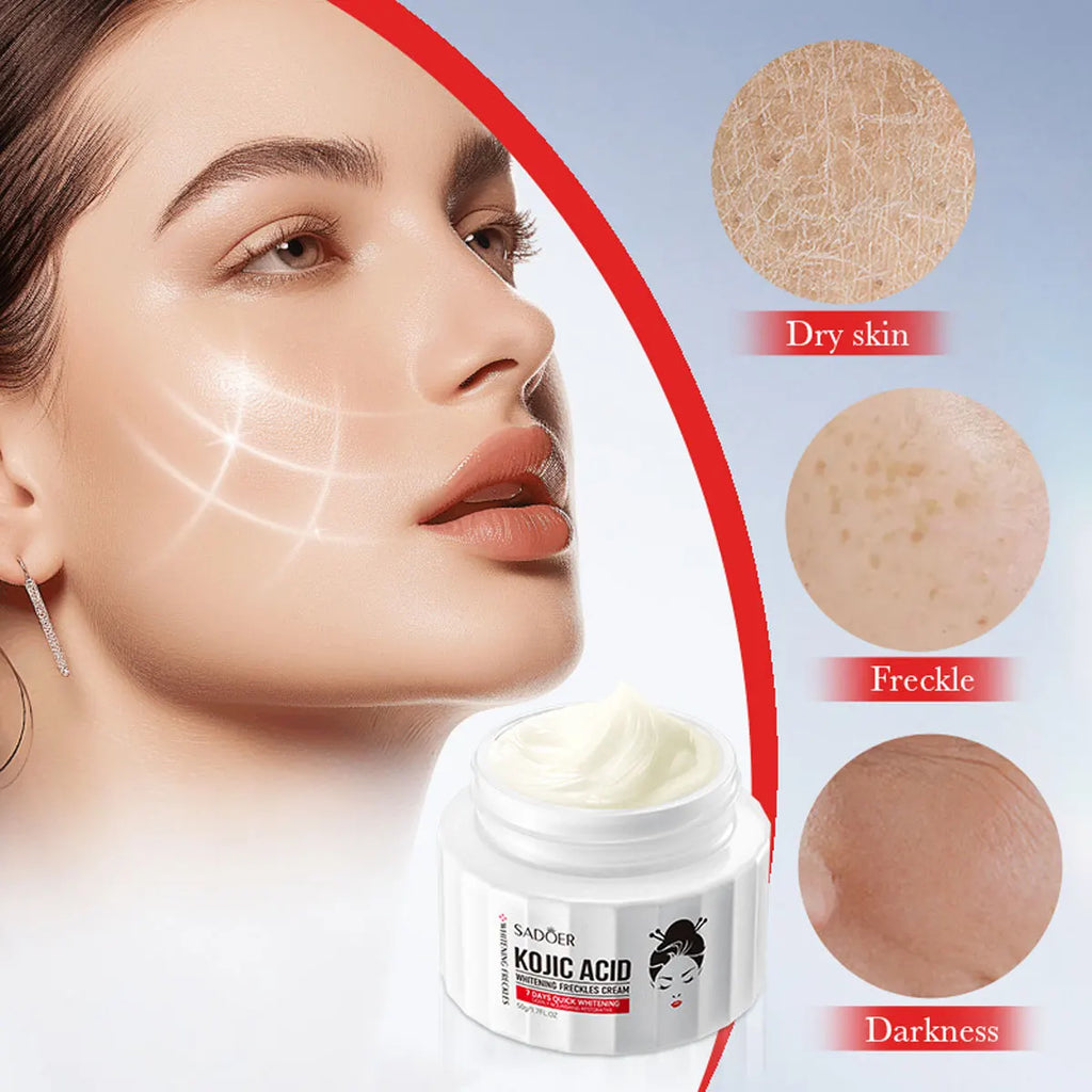 Kojic Acid Whitening&spot Removing Cream Moisturizing&brightening Face Qme