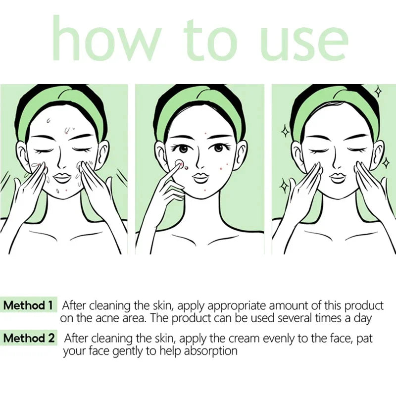 Herbal Acne Removal Face Cream Clears Pimple Scar Black Dots Gel Acne Treatment Shrink Pore Skin Whitening Lightening Ointment Qme