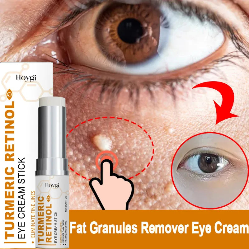 Fat Granules Remover Eye Cream Anti-Puffiness Anti Inflammatory Reduce Dark Circles Eyebags Fade Lines Moisturizing Eye Care Qme