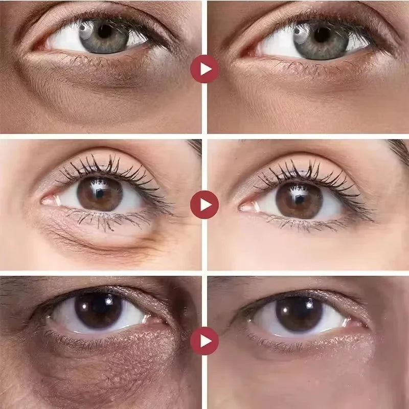 Instant Eye Bag Removal Cream Collagen Anti-Wrinkle Fade Fine Lines Firming Skin Anti Dark Circle Puffiness Brighten Eye Care Qme