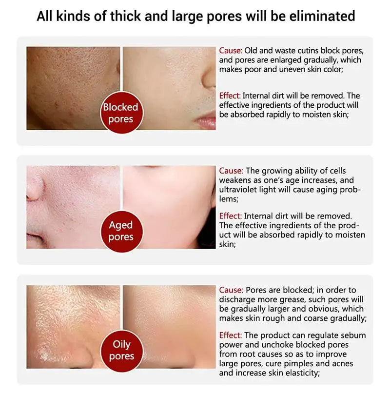 99%PDRN Collagen Face Mask Reduce Wrinkles Shrink Pores Deep Hydrating Overnight Mask Refreshing Brightening Face Skin Care Qme