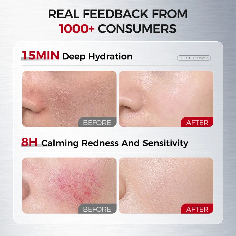 Moisturizing Calming Essence Lotion HA Ceramide Dry Redness Prone Skin Qme