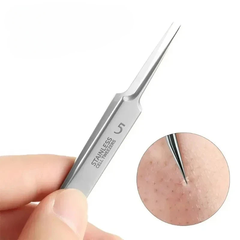 Blackhead Tweezers Precision Acne Removal Tool Facial Whiteheads Qme
