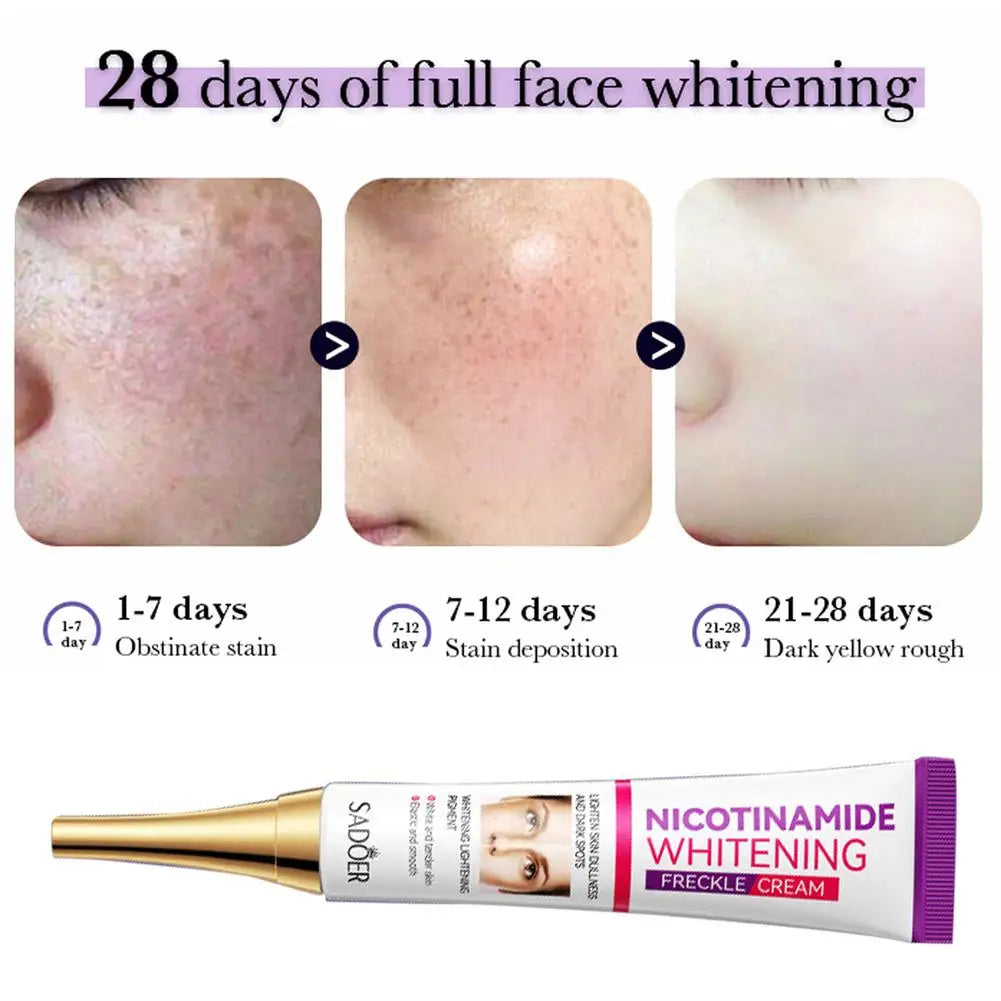 3pcs Nicotinamide Whitening Freckles Cream Remove Melasma Dark Spot Acne Marks Brightening Skin Tone Face Skin Care Qme