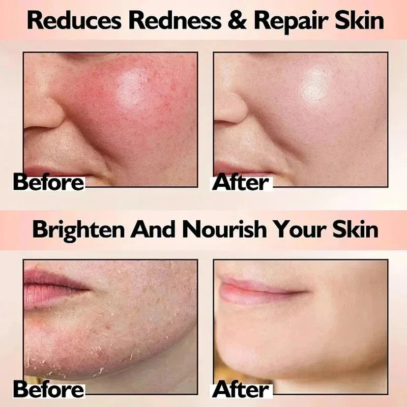 B5 Repair Cream Moisturizing Hydrating Effectively Solves Dry Chapped And Red Skin Nourishes Improve Repair Sunscreen Cream Qme