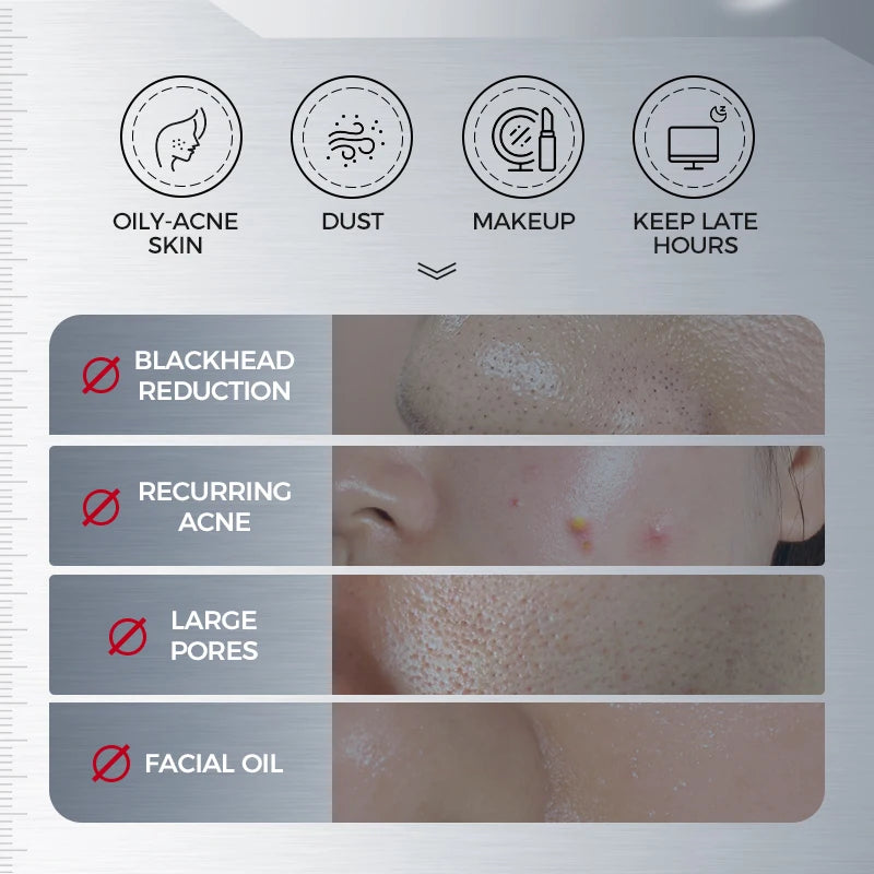 NING DERMOLOGIE Amino Acid Korean Facial Cleanser Salicylic Help Pore Qme