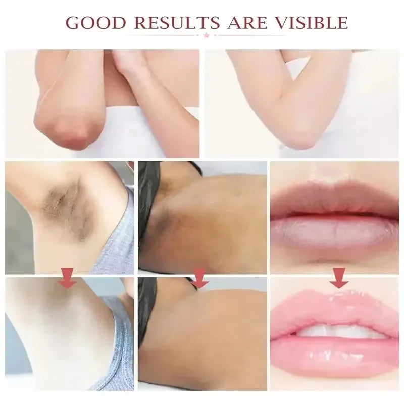 Whitening Cream For Dark Skin Underarm Bleaching Armpit Lightening And Intimate Area Woman Moisturizer Korean Skin Care Products Qme