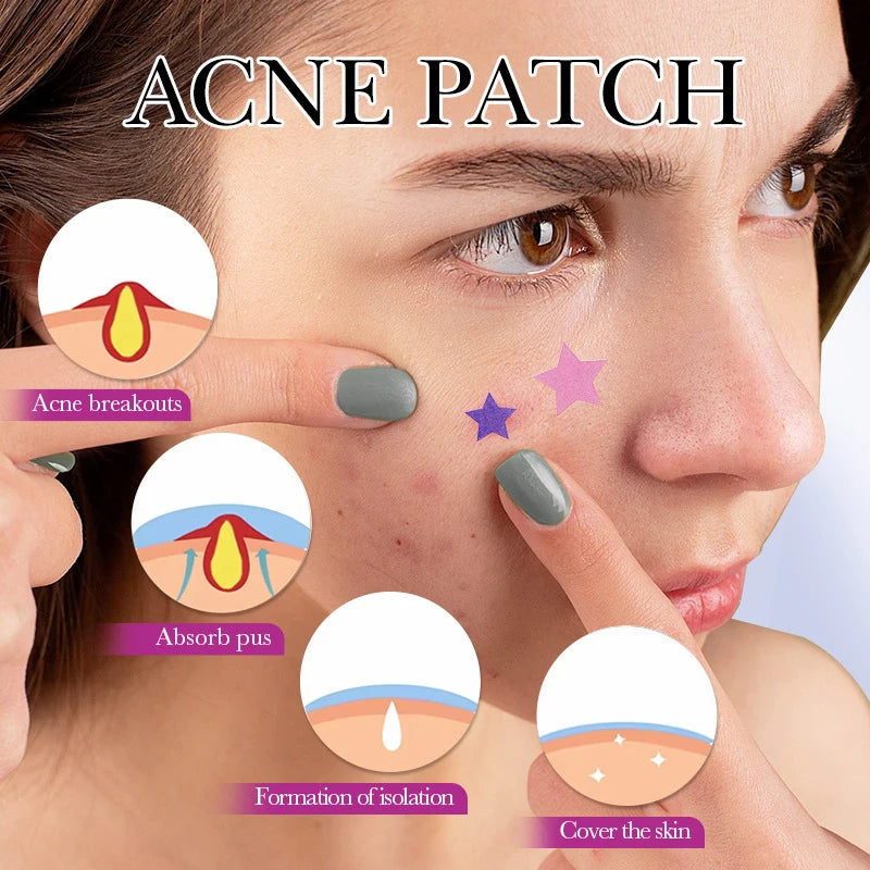 1Box 32 Patches Acne Patch Fade Repair Invisible Removal Stickers Qme