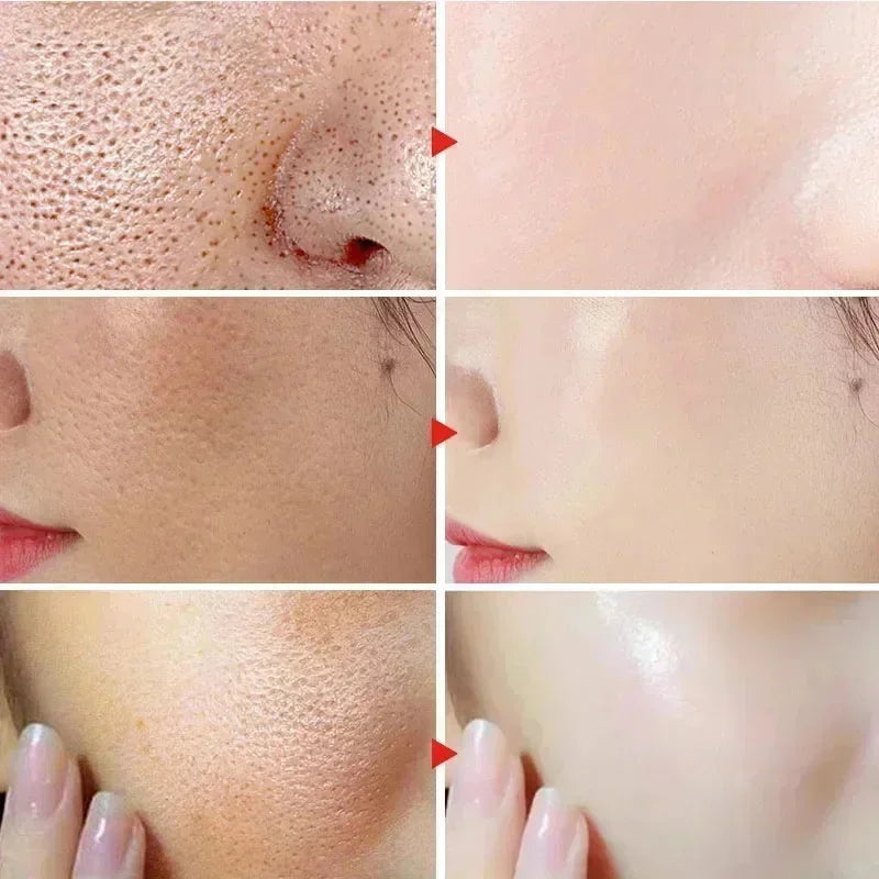 Remove Large Pores Serum Lactic Acid Facial Pore Shrinking Repairing Qme