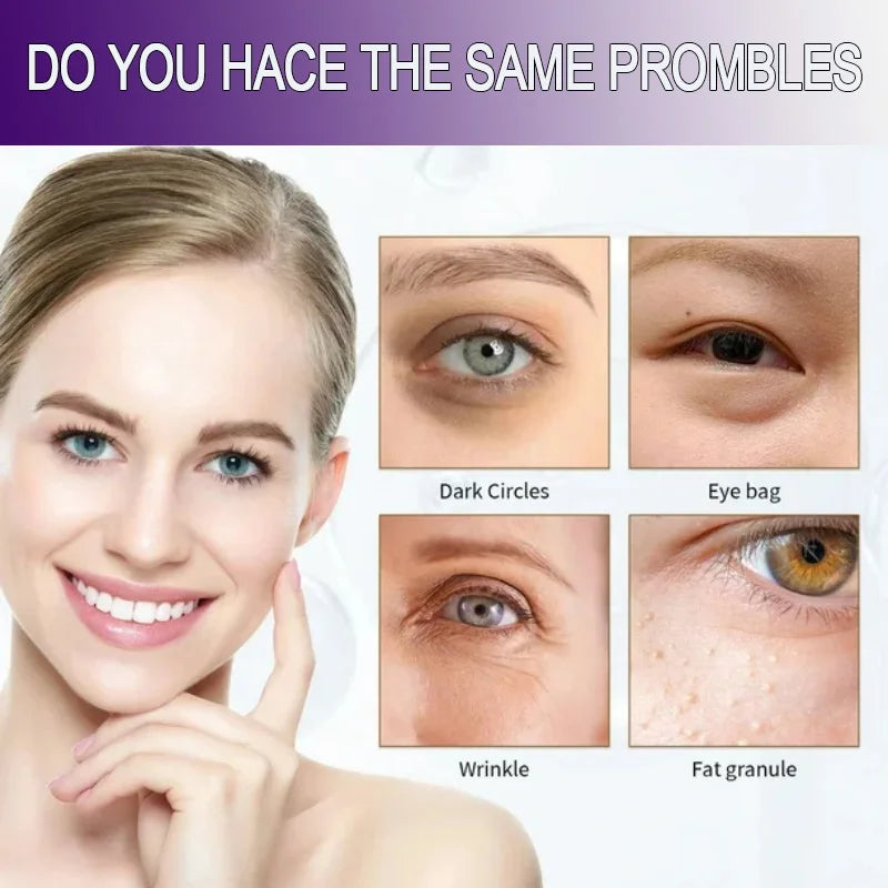 Retinol Eye Cream Collagen Multibalm Stick Reduce Wrinkles Eye Bag Hyaluronic Acid Anti Dark Circle Puffiness Eye Care Products Qme