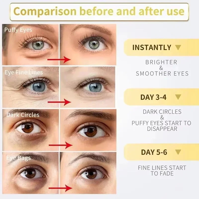 Instant Eye Bag Removal Cream Collagen Anti-Wrinkle Fade Fine Lines Firming Skin Anti Dark Circle Puffiness Brighten Eye Care Qme