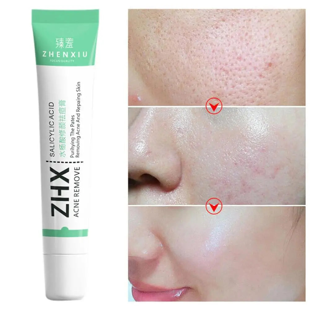 Salicylic Acid Shrink Pore Cream Elimination Large Pores Remove Qme