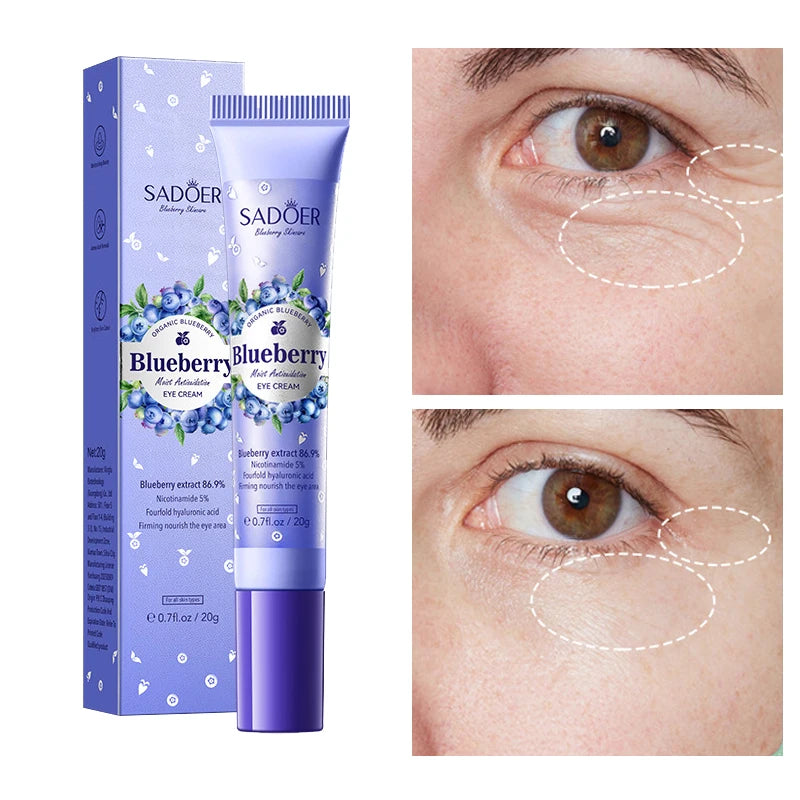 Blueberry Eye Cream Moisturizing Water Locking Firming Skin Care Qme