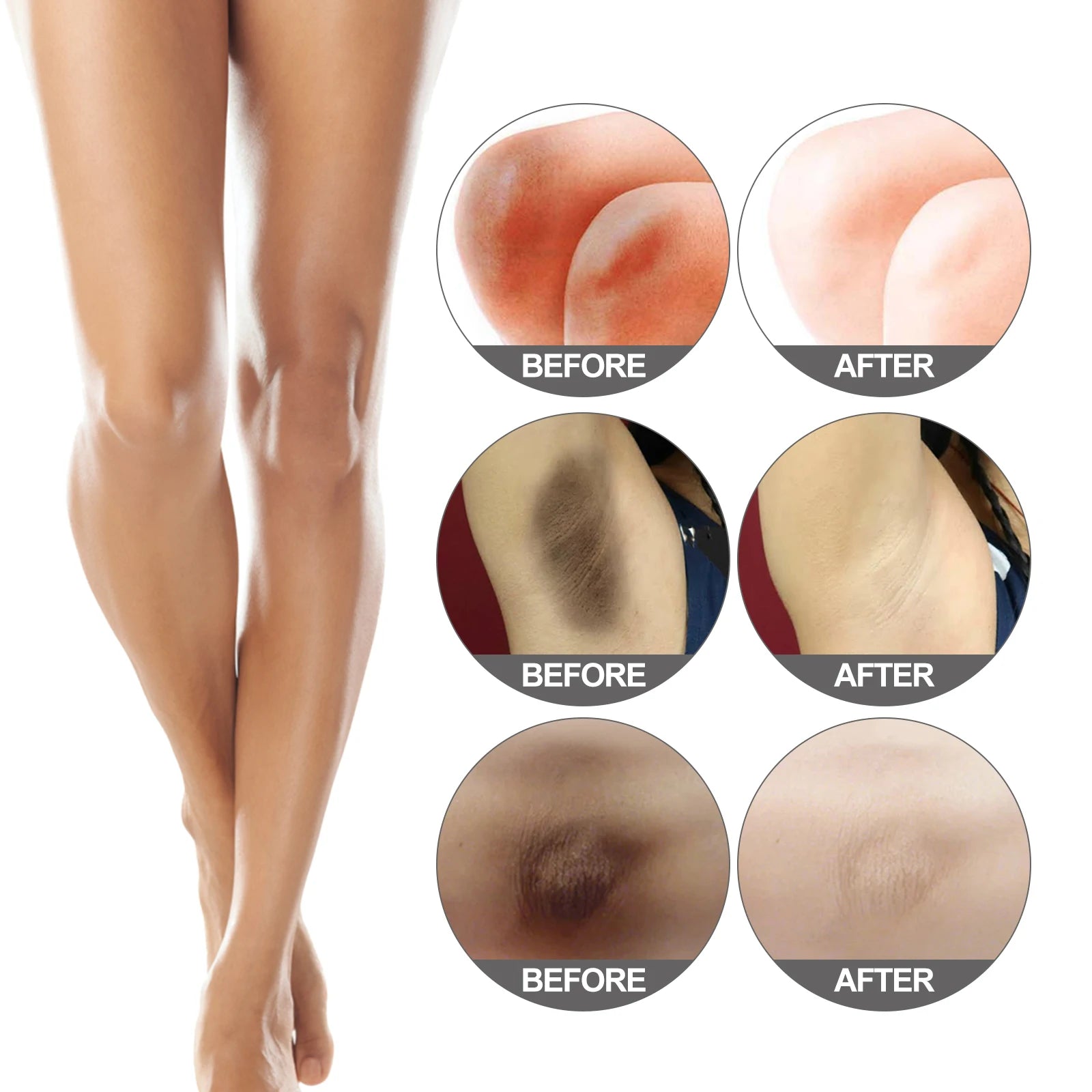 Body Snow Bleach Cream Nicotinamide Brighten Private Parts Underarm Bleaching Armpit Elbow Knees Joint Removal Dark Spot Melanin Qme
