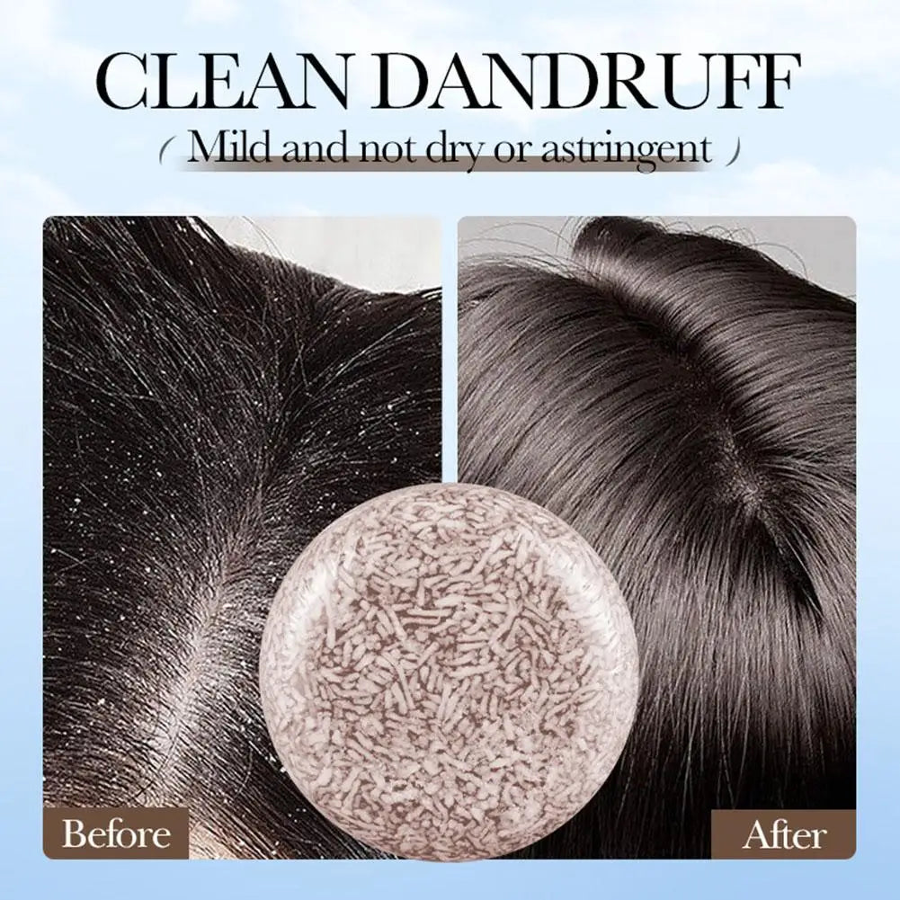 Bamboo Charcoal Shampoo Soap Anti Dandruff Anti Itching Deep Cleansing Hair Soap Lightening Strengthening Hair Roots Refreshing Qme