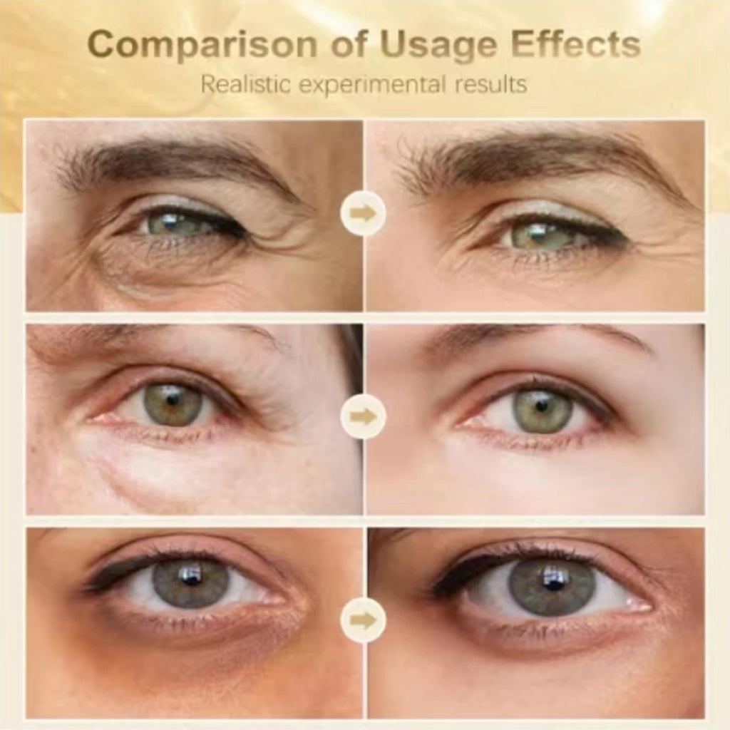 EXE CREAM 010 Eye Cream with Retinol & Hyaluronic Acid - Moisturizing, Smoothing & Protective Anti-Aging Eye Treatment Qme