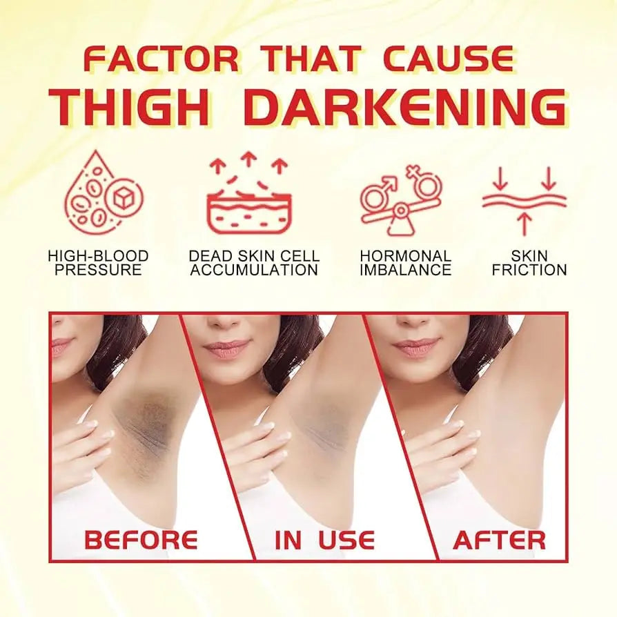 Body Whitening Cream Private Parts Underarm Dark Skin Bleaching Serum Niacinamide Whitening Lighten Dark Spots Snow Bleach Cream Qme
