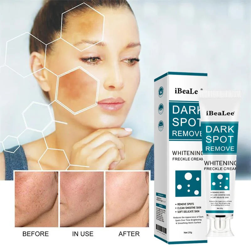 Melasma Brightening Face Cream Niacinamide Serum Brighten Cream Fade Fine Lines Lighten Dark Dot Reduce Melanin Face Skincare Qme
