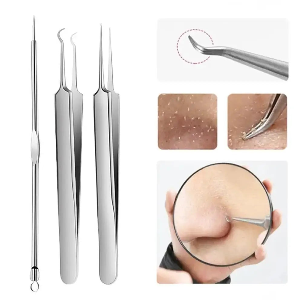 Acne Needle Blackhead Clip Remover Extraction Pore Black Head Clean Qme