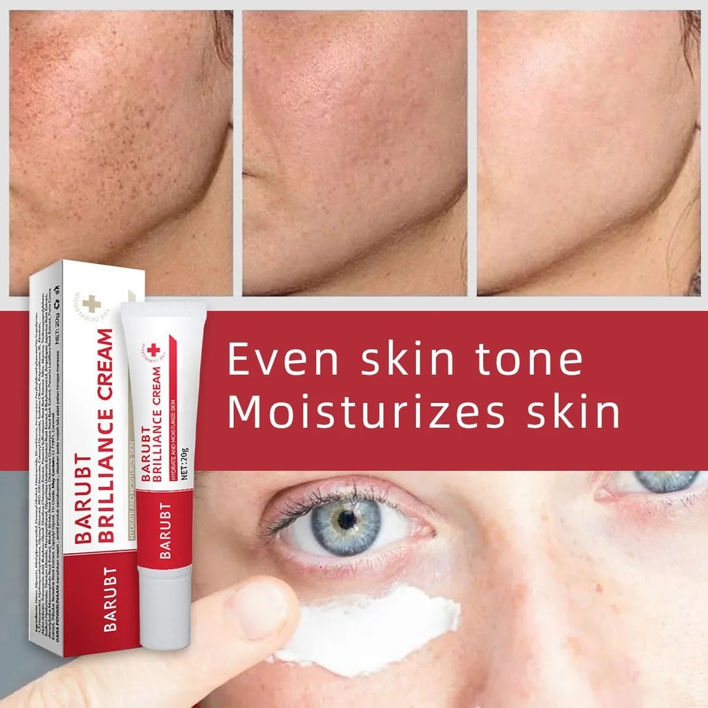 Whitening Freckles Face Cream Removal Melasma Dark Spots Corrector Lighten Melanin Pigmentation Brighten Anti-Aging Beauty Care Qme