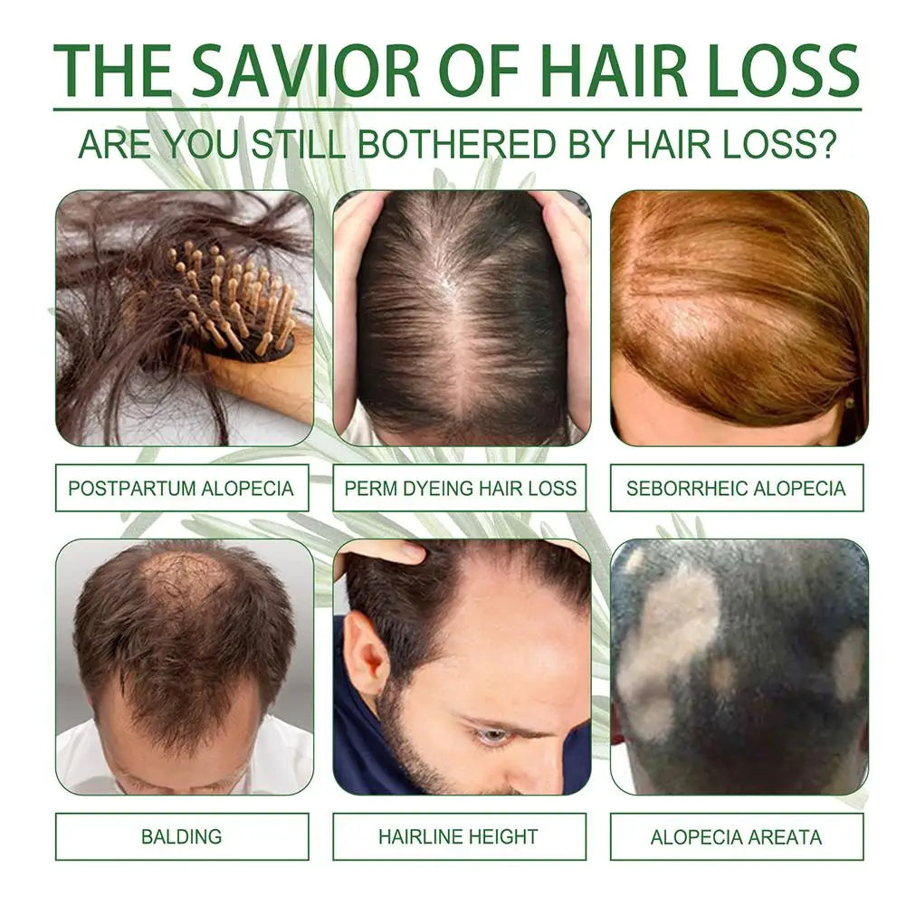 Rosemary Oil Hair Growth Essential Coconut Improve Loss Nourishes Qme