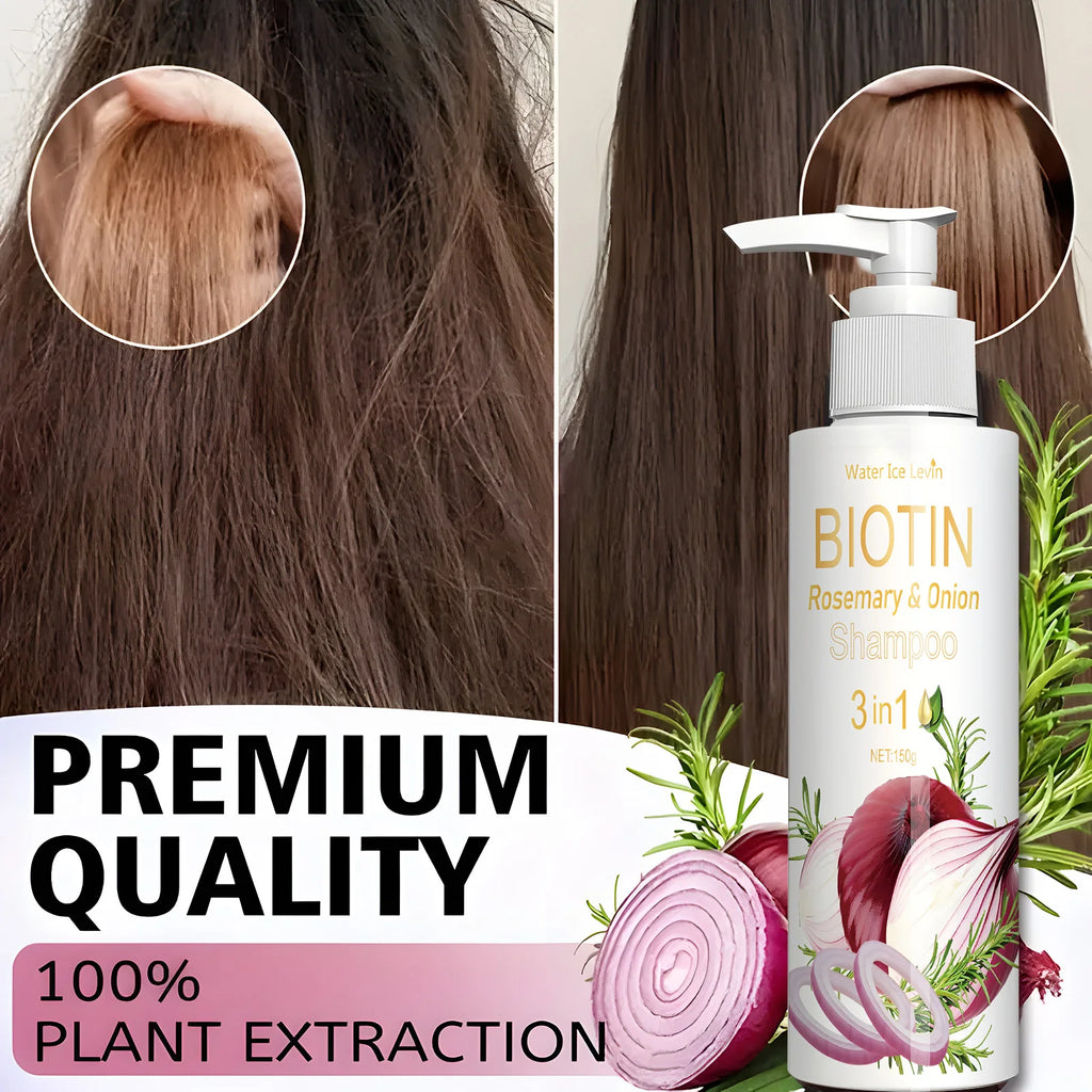 Biotin Rosemary & Onion 3 in 1 shampoo to strengthen hair roots, scalp repair, anti-thinning, moisturizing, thickening hair care Qme