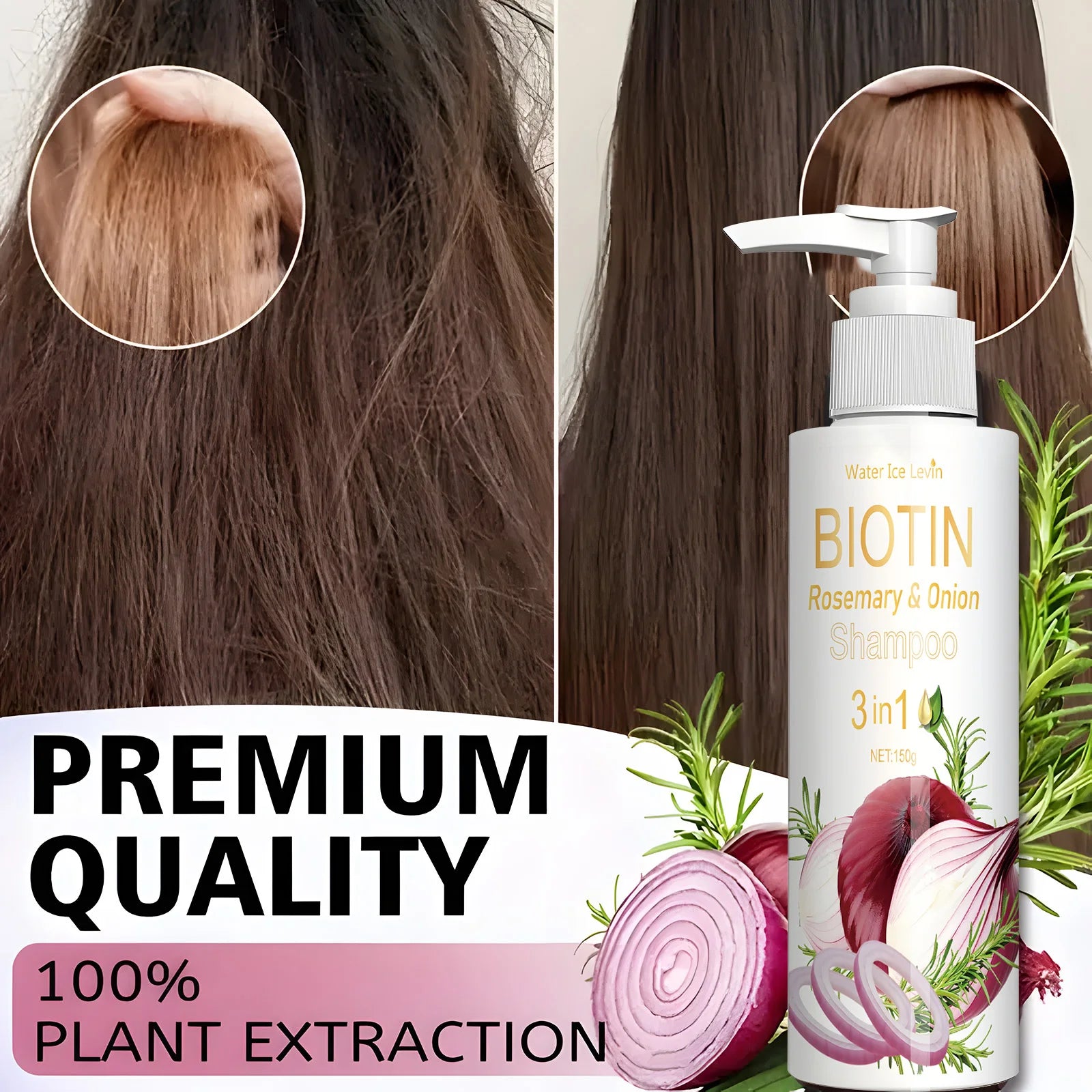 Biotin Rosemary & Onion 3 in 1 shampoo to strengthen hair roots, scalp repair, anti-thinning, moisturizing, thickening hair care Qme
