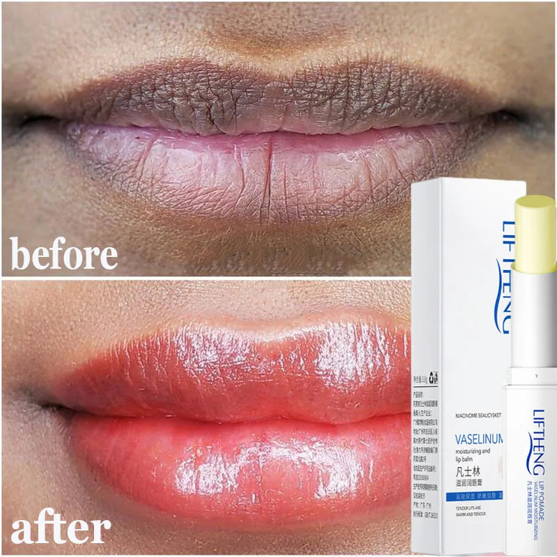 Remove Dark Smoke Lip Balm Lightening Melanin Bleaching Gloss Oil Lips Pink Lipstick Exfoliating Fade Lip Lines Korean Cosmetics Qme